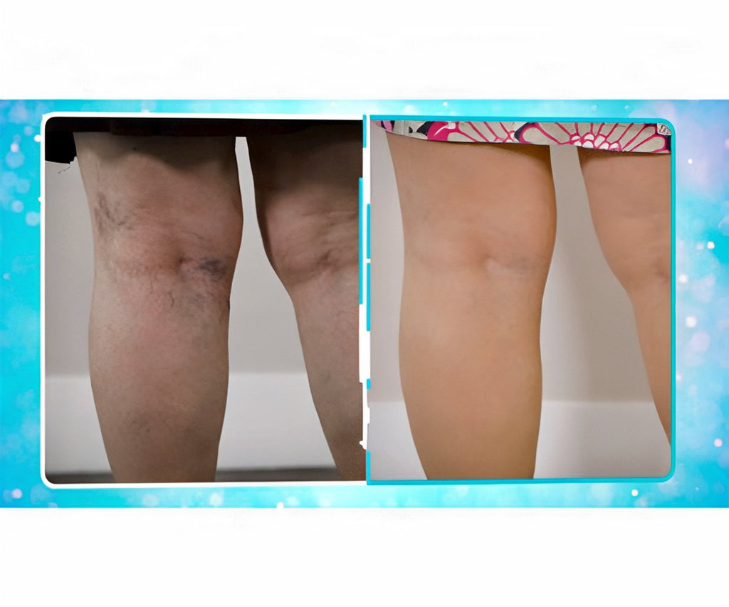 Veins Gone 2x1 a 39,99€